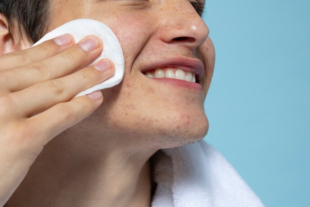 Men using cotton pad to clean his face
