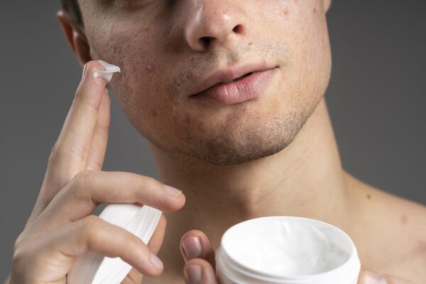 Men using his hand to put cream on his acne